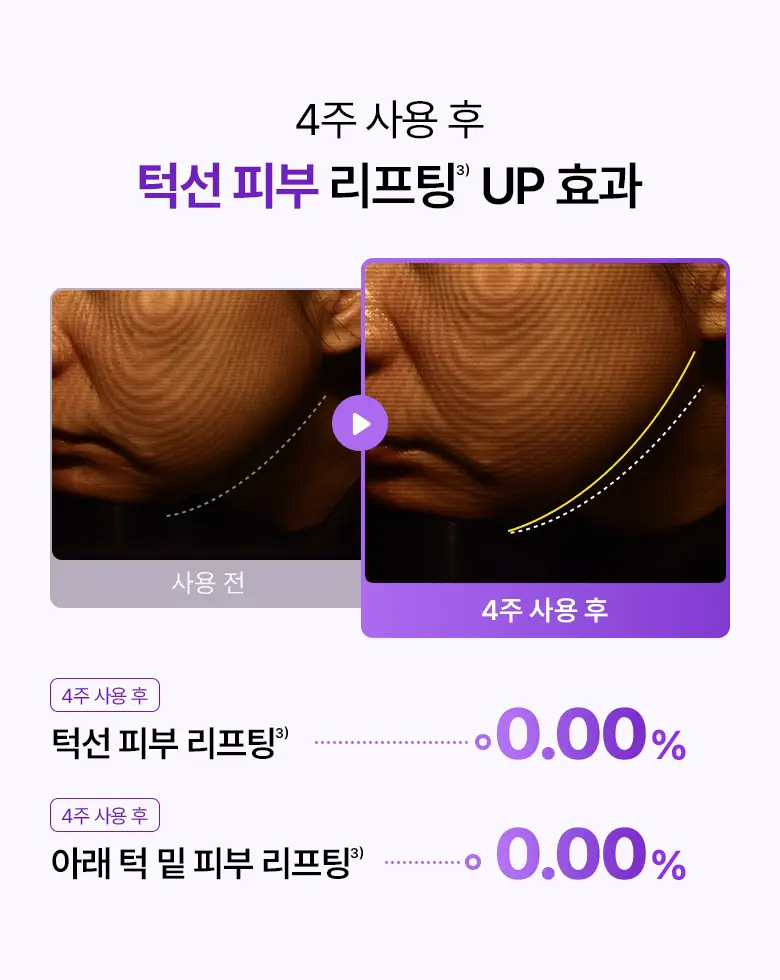 [카디비PICK|탄력보습] 바이오힐보 프로바이오덤 3D리프팅 크림 50ml [단품/기획] 상세페이지 15